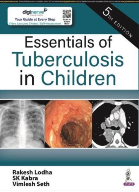 Essentials of Tuberculosis in Children, Paperback / softback Book