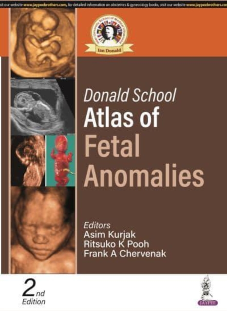 Donald School Atlas of Fetal Anomalies, Paperback / softback Book