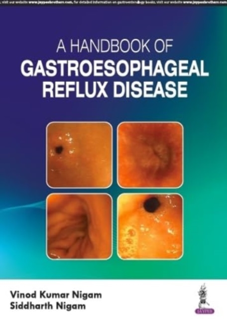 A Handbook of Gastroesophageal Reflux Disease (GERD), Paperback / softback Book