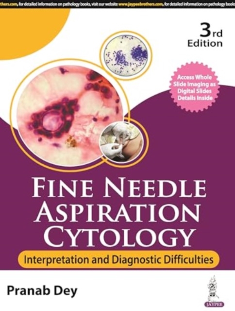 Fine Needle Aspiration Cytology : Interpretation and Diagnostic Difficulties, Paperback / softback Book