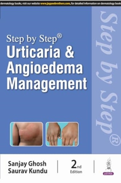 Step by Step: Urticaria & Angioedema Management, Paperback / softback Book