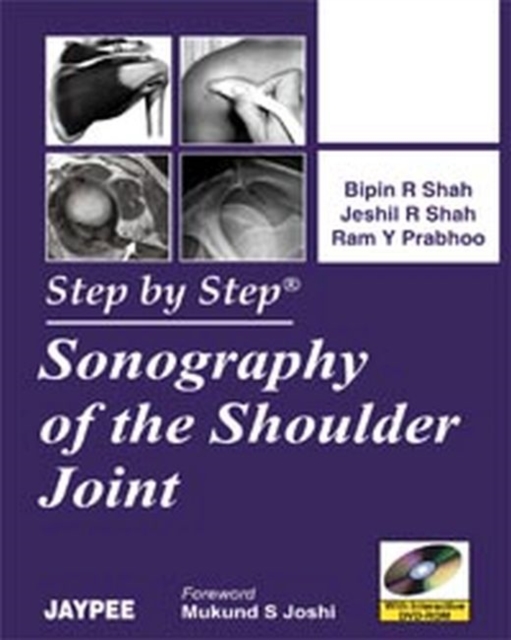 Step By Step Sonography of the Shoulder Joint, Paperback / softback Book