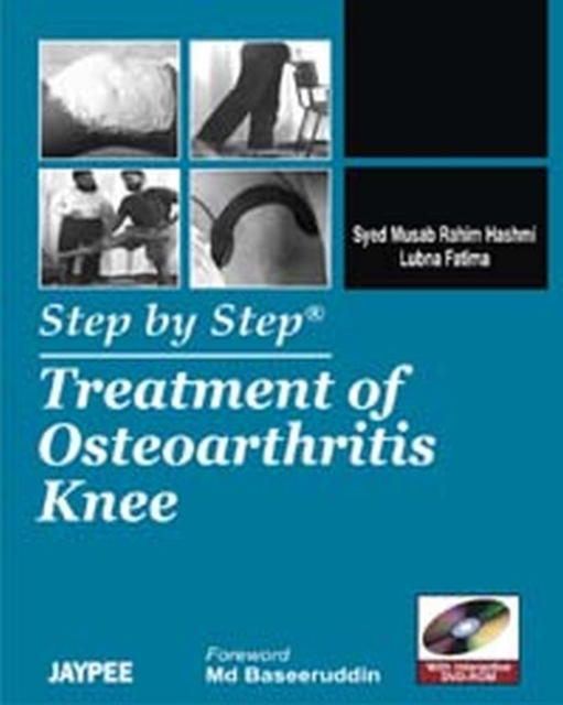 Step by Step: Treatment of Osteoarthritis Knee, Paperback / softback Book