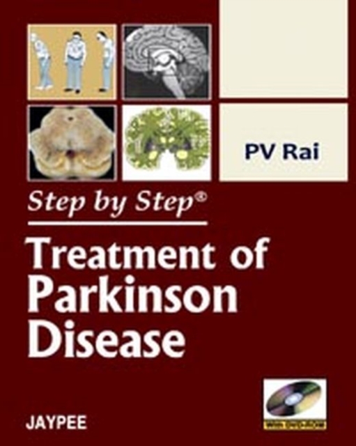 Step by Step: Treatment of Parkinson Disease, Paperback / softback Book
