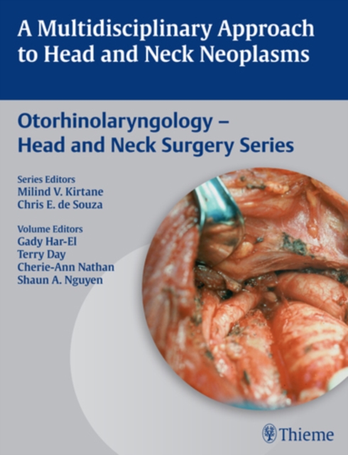 A Multidisciplinary Approach to Head and Neck Neoplasms, Hardback Book
