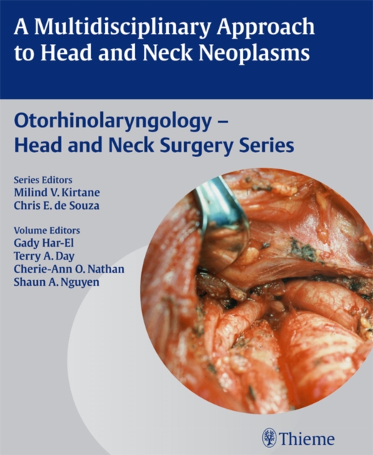 Multidisciplinary Approach to Head and Neck Neoplasms, EPUB eBook
