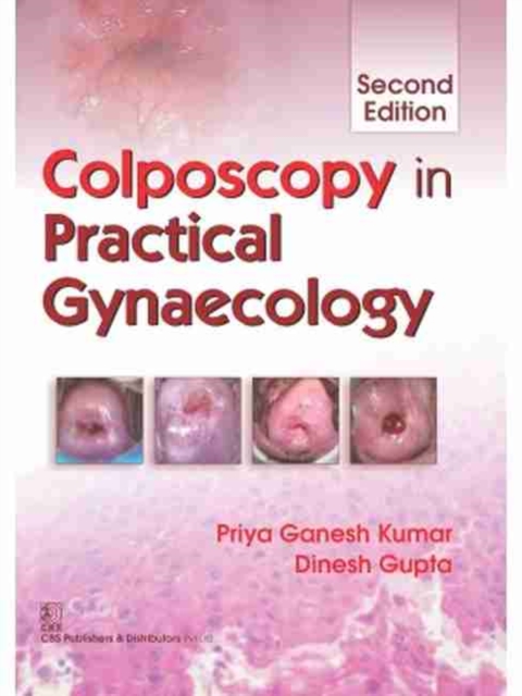 Colposcopy in Practical Gynecology, Paperback / softback Book