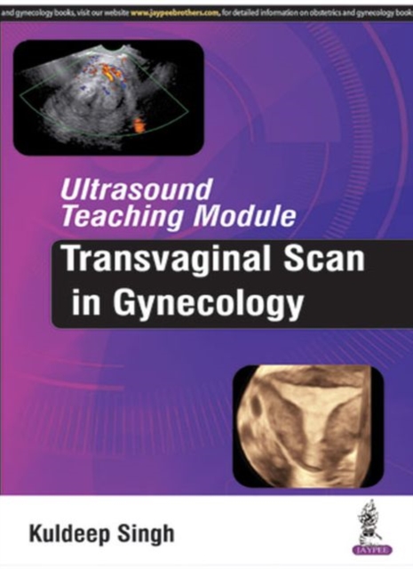 Ultrasound Teaching Module: Transvaginal Scan in Gynecology, Paperback / softback Book