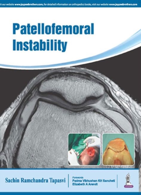 Patellofemoral Instability, Paperback / softback Book