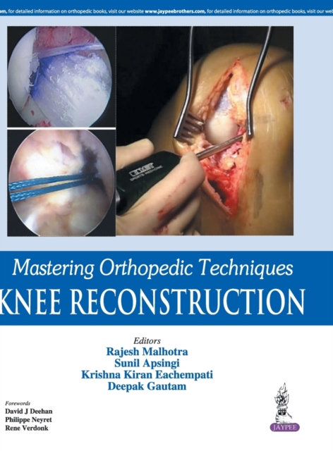Mastering Orthopedic Techniques: Knee Reconstruction, Hardback Book