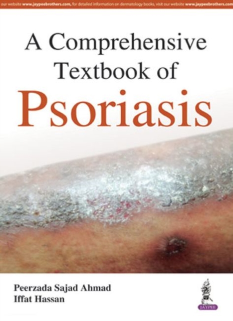 A Comprehensive Textbook of Psoriasis, Paperback / softback Book