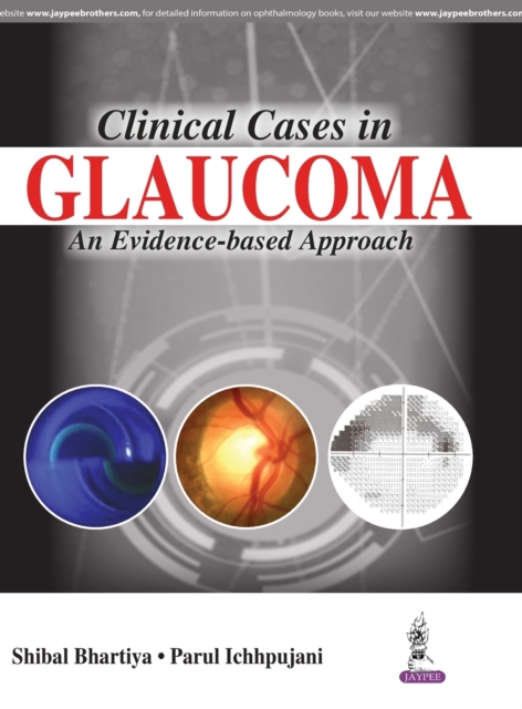 Clinical Cases in Glaucoma : An Evidence Based Approach, Paperback / softback Book