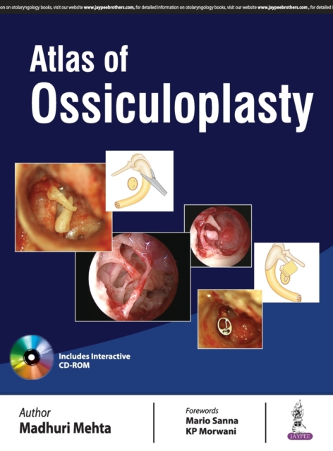 Atlas of Ossiculoplasty, Hardback Book