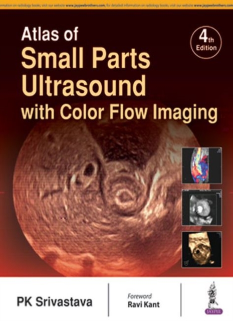 Atlas of Small Parts Ultrasound : with Color Flow Imaging, Hardback Book