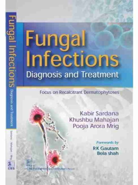 Fungal Infections : Diagnosis and Treatment, Hardback Book