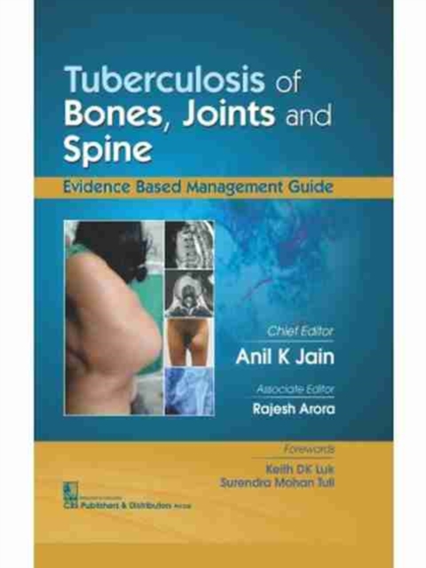 Tubercolosis of Bones, Joints and Spine, Paperback / softback Book