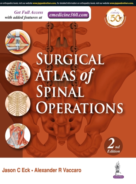 Surgical Atlas of Spinal Operations, Hardback Book