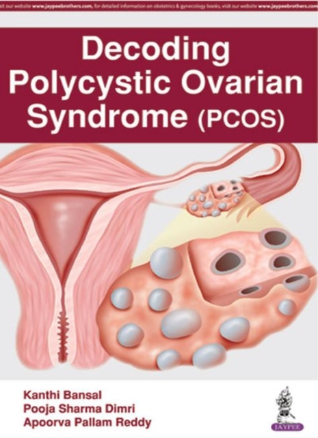 Decoding Polycystic Ovarian Syndrome, Paperback / softback Book