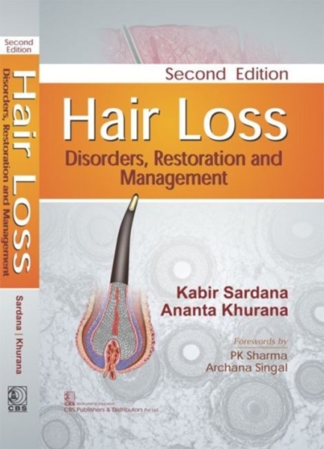 Hair Loss : Disorders, Restoration and Management, Hardback Book