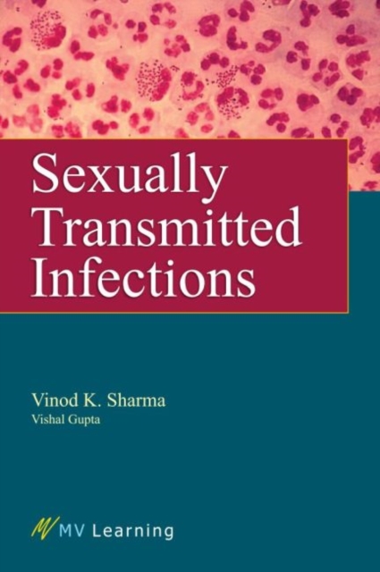 Sexually Transmitted Infections, Paperback / softback Book