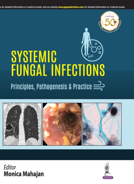 Systemic Fungal Infections: Principles, Pathogenesis & Practice, Paperback / softback Book