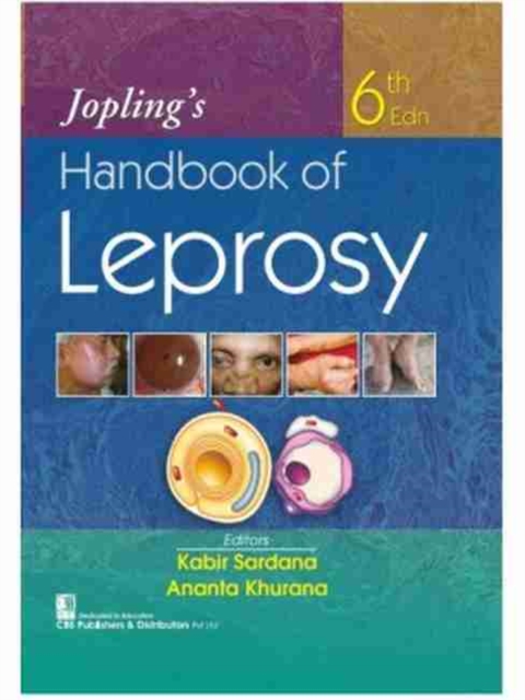 Jopling's Handbook of Leprosy, Hardback Book