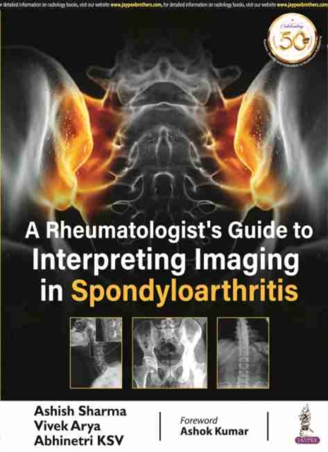 A Rheumatologist's Guide to Interpreting Imaging in Spondyloarthritis, Paperback / softback Book