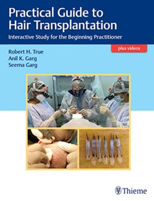Practical Guide to Hair Transplantation : Interactive Study for the Beginning Practitioner, Hardback Book