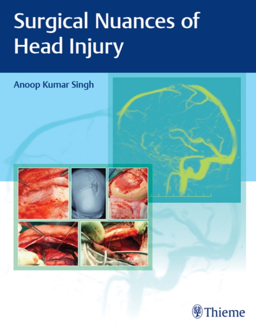 Surgical Nuances of Head Injury, EPUB eBook