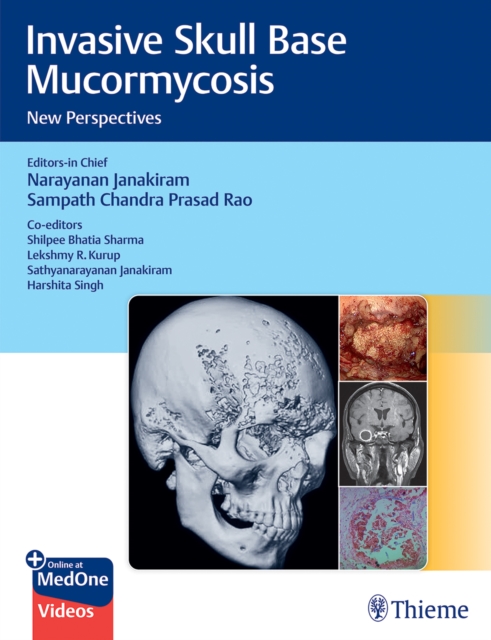 Invasive Skull Base Mucormycosis : New Perspectives, Multiple-component retail product, part(s) enclose Book