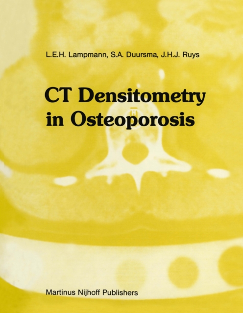 CT Densitometry in Osteoporosis : The impact on management of the patient, PDF eBook