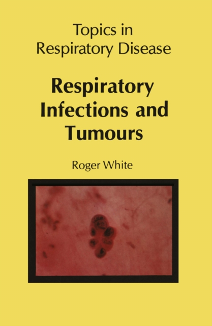 Respiratory Infections and Tumours, PDF eBook