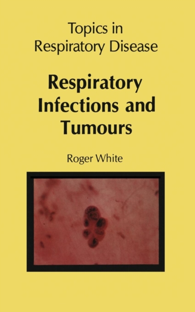 Respiratory Infections and Tumours, Paperback / softback Book