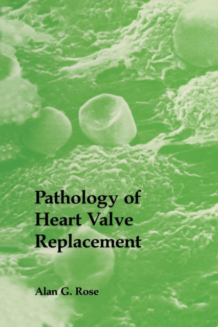 Pathology of Heart Valve Replacement, Paperback / softback Book
