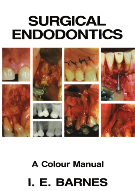 Surgical Endodontics : A Colour Manual, PDF eBook