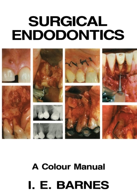 Surgical Endodontics : A Colour Manual, Paperback / softback Book