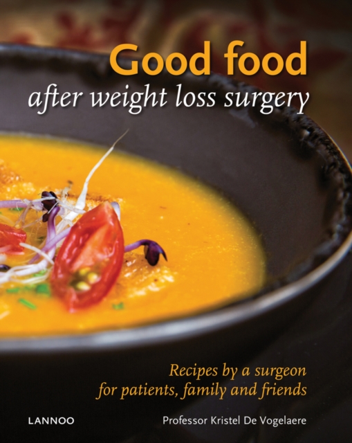 Good Food After Weight Loss Surgery, Hardback Book