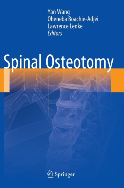 Spinal Osteotomy, Hardback Book