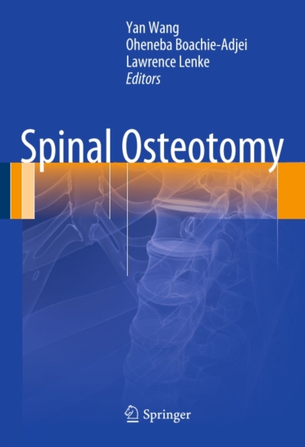 Spinal Osteotomy, PDF eBook