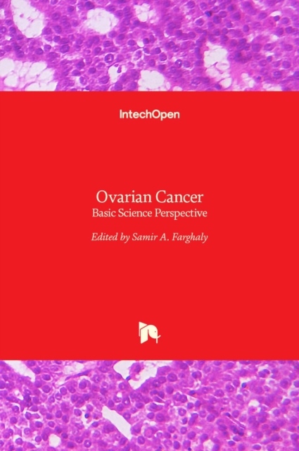 Ovarian Cancer : Basic Science Perspective, Hardback Book