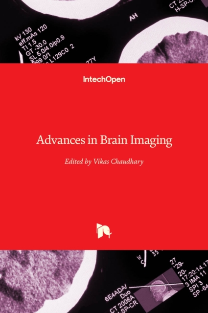 Advances in Brain Imaging, Hardback Book