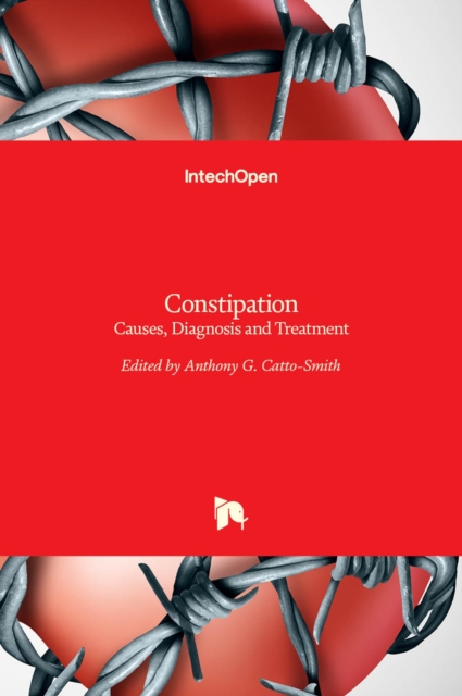 Constipation : Causes, Diagnosis and Treatment, Hardback Book