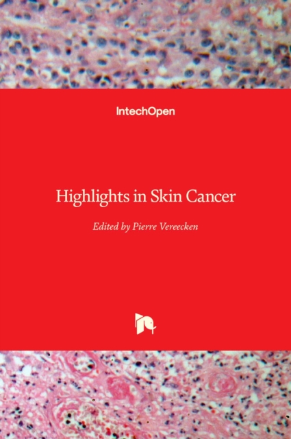 Highlights in Skin Cancer, Hardback Book
