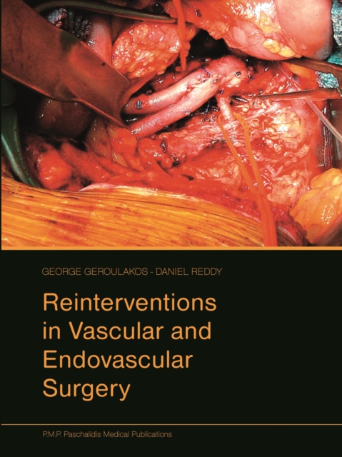 Reinterventions in Vascular and Endovascular Surgery, Hardback Book
