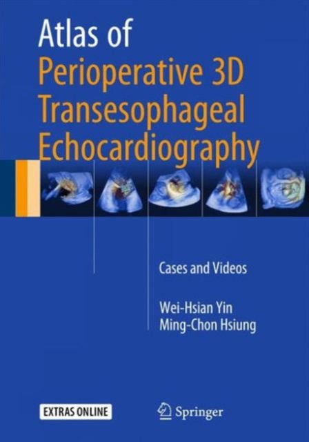 Atlas of Perioperative 3D Transesophageal Echocardiography : Cases and Videos, Hardback Book