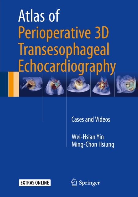 Atlas of Perioperative 3D Transesophageal Echocardiography : Cases and Videos, PDF eBook