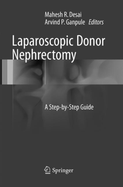 Laparoscopic Donor Nephrectomy : A Step-by-Step Guide, Paperback / softback Book