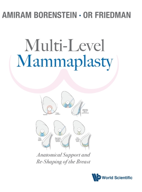 Multi-level Mammaplasty: Anatomical Support And Re-shaping Of The Breast, Hardback Book