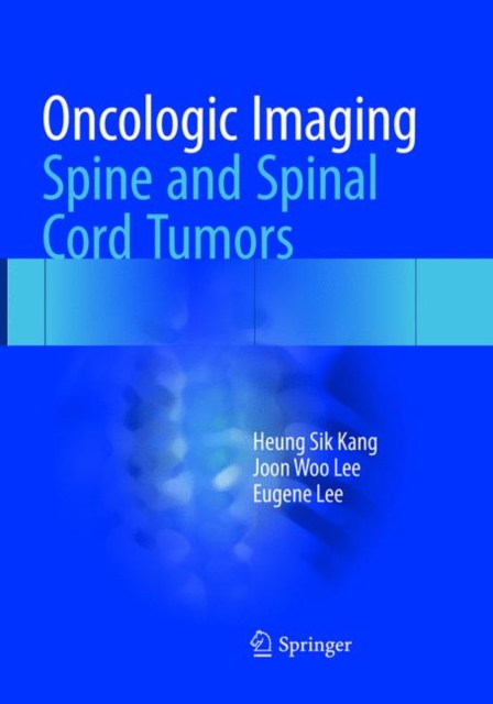 Oncologic Imaging: Spine and Spinal Cord Tumors, Paperback / softback Book