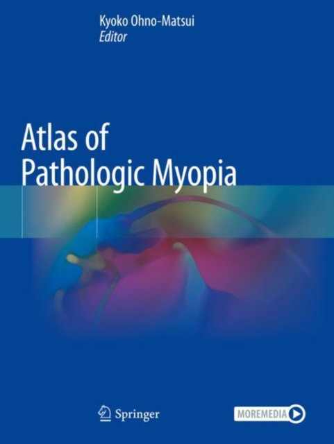 Atlas of Pathologic Myopia, Paperback / softback Book